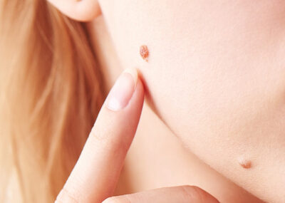 odos-dariniu-salinimas