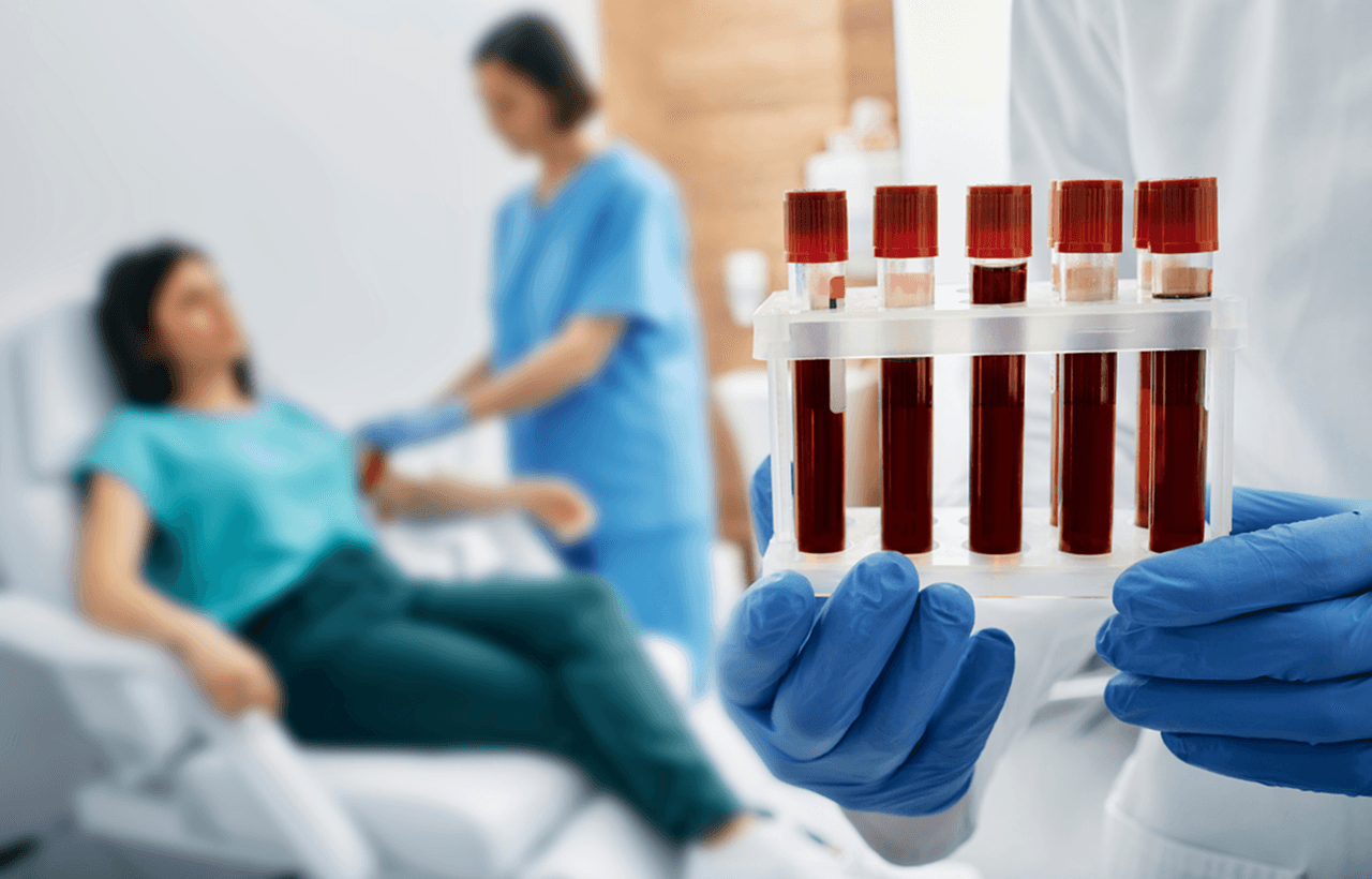 Kraujo tyrimas, maisto netoleravimo tyrimas